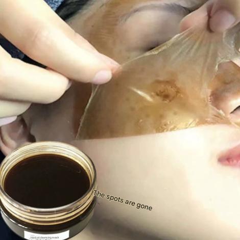 Beauty salon spot mask removing dark yellow melanin removing blackhead acne whitening freckle cleansing skin mask tearing mask